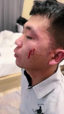 图片[6]_【宸宸】挑战无终止-御姐皮板鞋底抽耳光/掐肉虐乳 bf25938_HD绳艺资源