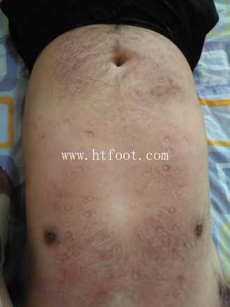 图片[1]_踩踏毯子消磨时间2_HD绳艺资源