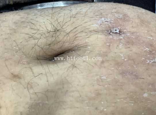 图片[1]_185斤高171女主全体重红色高跟鞋踩踏 虐乳_HD绳艺资源