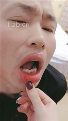 图片[11]_【昭玥】高难度挑战抽耳光/揪耳朵/高跟碾压狗头_HD绳艺资源