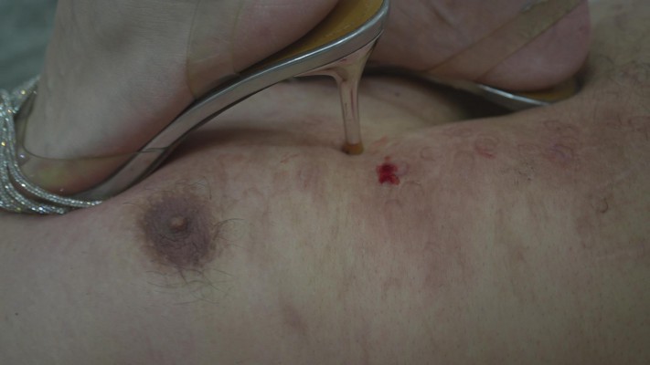 图片[7]_伤口高跟循环碾踩 血肉模糊 肉粒翻出 真正意义的麻木羞辱残忍 YC-240805-3_HD绳艺资源