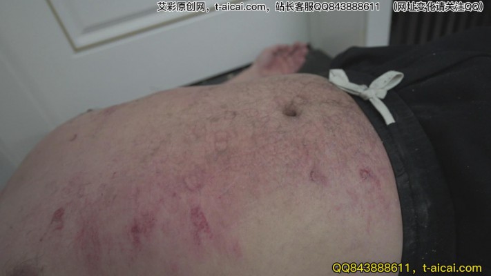 兔子牙 超模之下体无完肤 旧伤新伤持续腐烂 YC-230303-2_HD绳艺资源