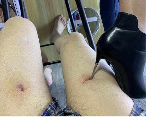 超细打磨的鞋跟大腿钻血洞，10和12厘米高跟跺肚子 YC-211012-3