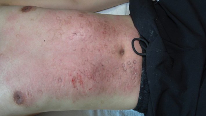 【彼岸花】高跟暴踩血痕脚垫 YC-220911-4