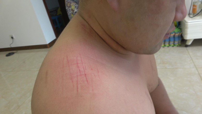 冷柔平底鞋暴喘猪头